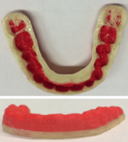 3D printed mouthguard for oral drug delivery